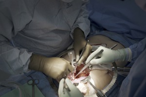 器官移植黑市有解？中國科學家在豬體培育出人類腎臟