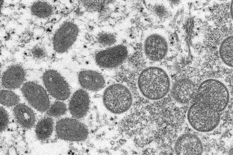 世界卫生组织表示，猴痘在世界范围内的持续传播可能会导致病毒开始进入高危人群，包括孕妇、免疫功能低下的人和儿童等。 (美联社)